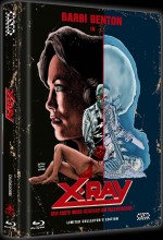 X-Ray (Cover B)